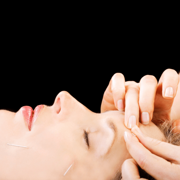 Facial acupuncture